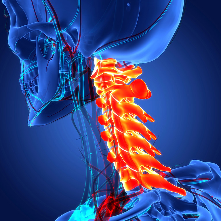 skeletal